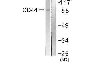 Western blot analysis of extracts from NIH/3T3 cells, treated with PMA (250ng/ml, 5mins), using CD44 (Ab-706) antibody. (CD44 Antikörper)