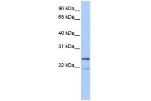 BTF3L3 antibody used at 1 ug/ml to detect target protein. (BTF3P13 Antikörper  (Middle Region))