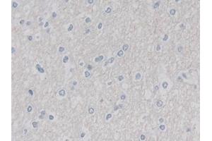 Detection of CUL9 in Human Cerebrum Tissue using Polyclonal Antibody to Cullin 9 (CUL9) (CUL9 Antikörper  (AA 1144-1322))