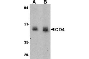 Western Blotting (WB) image for anti-CD4 (CD4) antibody (ABIN1031728) (CD4 Antikörper)