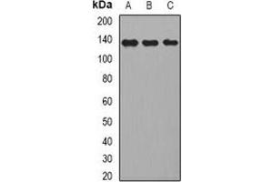 Western blot analysis of CD22 expression in HepG2 (A), Raji (B), mouse liver (C) whole cell lysates. (CD22 Antikörper)