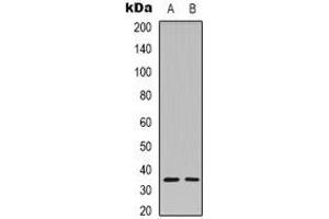 Western blot analysis of Caspase 3 p12 expression in Hela (A), MCF7 (B) whole cell lysates. (Caspase 3 p12 Antikörper)