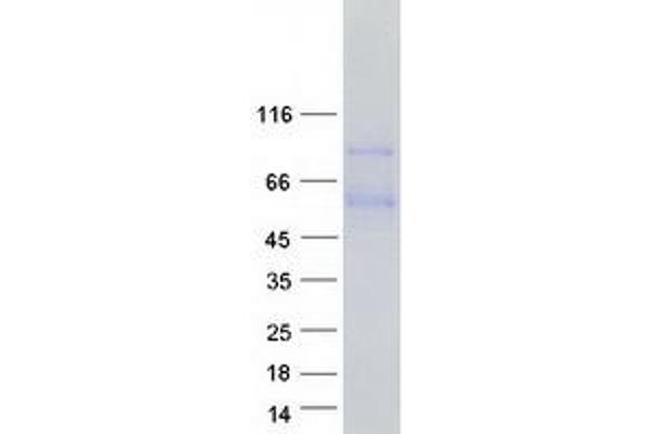 PRELP Protein (Transcript Variant 2) (Myc-DYKDDDDK Tag)