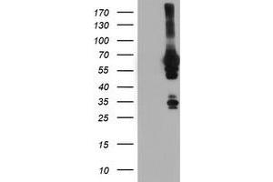 HEK293T cells were transfected with the pCMV6-ENTRY control (Left lane) or pCMV6-ENTRY NMT2 (Right lane) cDNA for 48 hrs and lysed. (NMT2 Antikörper)