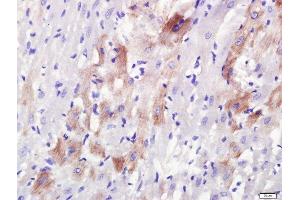 Paraformaldehyde-fixed, paraffin embedded rat heart, Antigen retrieval by boiling in sodium citrate buffer (pH6. (Rab3a+Rab3b+Rab3c+Rab3d (AA 101-150) Antikörper)