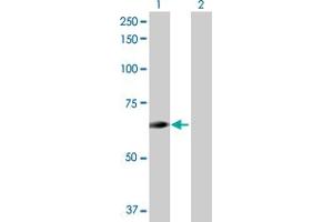 Lane 1: ENTPD4 transfected lysate ( 62. (ENTPD4 293T Cell Transient Overexpression Lysate(Denatured))