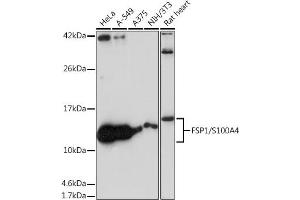 Western blot analysis of extracts of various cell lines, using FSP1/S100 antibody (ABIN7270125) at 1:1000 dilution. (s100a4 Antikörper)