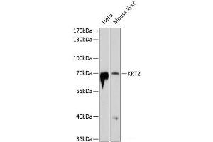 Western blot analysis of extracts of various cell lines using KRT2 Polyclonal Antibody at dilution of 1:1000. (Keratin 2 Antikörper)