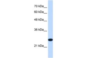 Western Blotting (WB) image for anti-Transmembrane Protein 109 (TMEM109) antibody (ABIN2463292) (TMEM109 Antikörper)