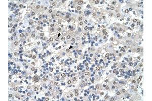 CDR2 antibody was used for immunohistochemistry at a concentration of 4-8 ug/ml to stain Hepatocytes (arrows) in Human Liver. (CDR2 Antikörper  (N-Term))