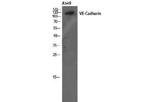 Western Blotting (WB) image for anti-Cadherin 5 (CDH5) (Ser225) antibody (ABIN3187462) (Cadherin 5 Antikörper  (Ser225))
