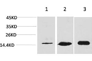 Western blot analysis of 1) Hela, 2) 3T3, 3) rat brain tissue using MAP LC3β Polyclonal Antibody. (LC3B Antikörper)