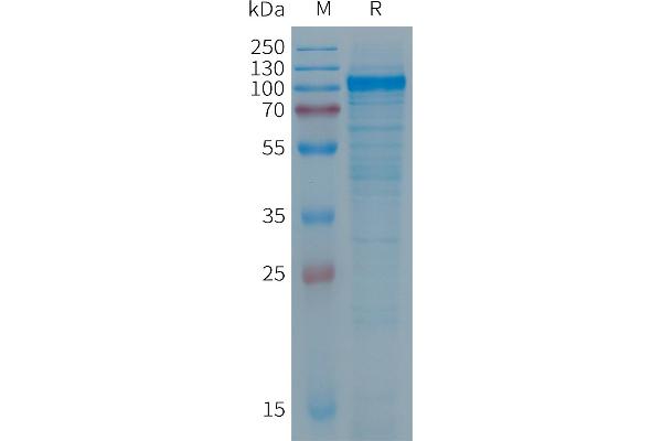 PTGFRN Protein (AA 26-830) (His tag)