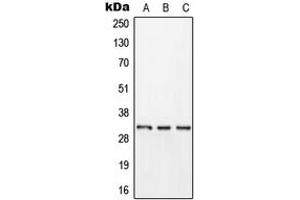 Western blot analysis of Kallikrein 11 expression in HEK293T (A), HepG2 (B), rat brain (C) whole cell lysates. (Kallikrein 11 Antikörper  (Center))