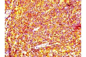 Immunohistochemistry (IHC) image for anti-B-Cell CLL/lymphoma 2 (BCL2) antibody (ABIN7127273)