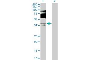 Western Blot analysis of SQSTM1 expression in transfected 293T cell line by SQSTM1 MaxPab polyclonal antibody. (SQSTM1 Antikörper  (AA 1-440))
