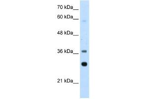 WB Suggested Anti-RPLP0 Antibody Titration:  2. (RPLP0 Antikörper  (Middle Region))