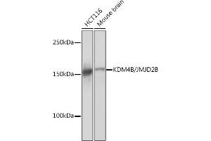 Western blot analysis of extracts of various cell lines, using KDM4B/JMJD2B Rabbit mAb (ABIN7268329) at 1:1000 dilution. (KDM4B Antikörper)