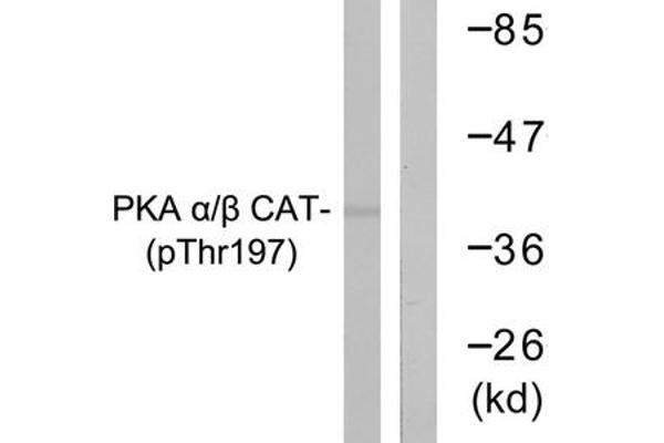 PRKACA Antikörper  (pThr197)