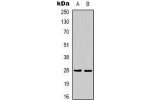 Western blot analysis of 14-3-3 epsilon expression in mouse brain (A), rat brain (B) whole cell lysates. (YWHAE Antikörper)