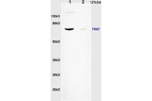 L1 human colon carcinoma lysates L2 rat brain lysates probed with Anti KIFC1 Polyclonal Antibody, Unconjugated (ABIN873143) at 1:200 overnight at 4 °C. (KIFC1 Antikörper)