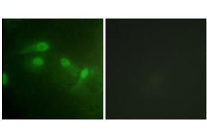 Immunofluorescence analysis of HeLa cells, using MDM2 (Phospho-Ser186+Ser188) antibody. (MDM2 Antikörper  (pSer186, pSer188))