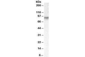 Western blot testing of human placenta lysate with Factor XIIIa antibody at 0. (F13A1 Antikörper)