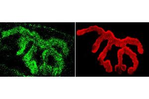 Immunohistochemistry analysis using Rabbit Anti-Piccolo Polyclonal Antibody . (Piccolo Antikörper  (PE))