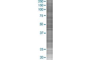 WNT2B transfected lysate. (WNT2B 293T Cell Transient Overexpression Lysate(Denatured))