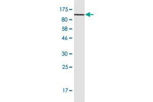 Western Blot detection against Immunogen (102. (CD44 Antikörper  (AA 1-699))