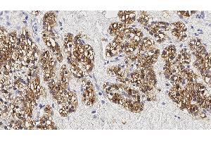 Immunohistochemistry (IHC) image for anti-Parathyroid Hormone (PTH) antibody (ABIN7538931) (PTH Antikörper)