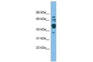 SHMT1 antibody used at 1 ug/ml to detect target protein. (SHMT1 Antikörper)