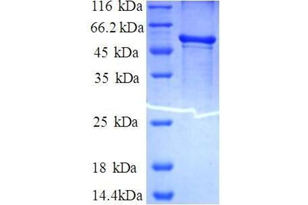 FTH1 Protein (AA 2-183, full length) (GST tag)