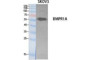Western Blotting (WB) image for anti-Bone Morphogenetic Protein Receptor 1A (BMPR1A) (Internal Region) antibody (ABIN3181068) (BMPR1A Antikörper  (Internal Region))
