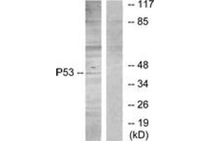 Western blot analysis of extracts from HT29 cells, using p53 (Ab-315) Antibody. (p53 Antikörper  (AA 281-330))