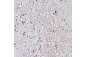 Immunohistochemistry of paraffin-embedded rat brain using TPD52 antibody  at dilution of 1:100 (40x lens). (TPD52 Antikörper  (AA 1-184))