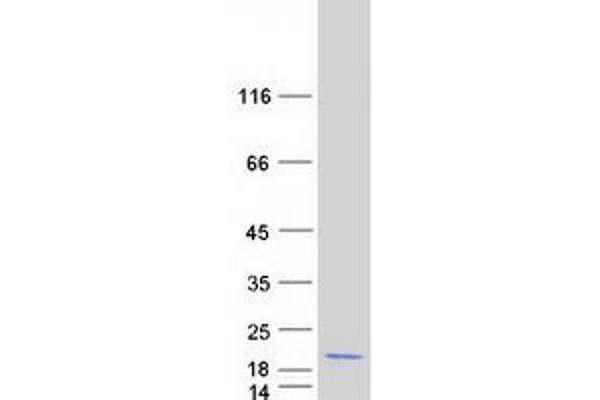 MCFD2 Protein (Myc-DYKDDDDK Tag)