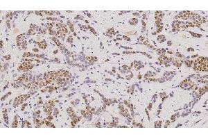 Immunohistochemistry (IHC) image for anti-Estrogen Receptor 1 (ESR1) antibody (ABIN7538886) (Estrogen Receptor alpha Antikörper)