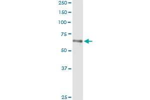 Western Blotting (WB) image for HLX (Human) IP-WB Antibody Pair (ABIN1341457)