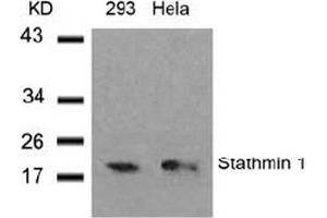 Image no. 3 for anti-Stathmin 1 (STMN1) (Ser37) antibody (ABIN197457) (Stathmin 1 Antikörper  (Ser37))