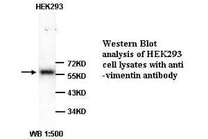 Image no. 1 for anti-Vimentin (VIM) (Internal Region) antibody (ABIN791058) (Vimentin Antikörper  (Internal Region))