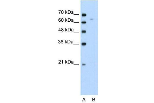 TOX Antikörper  (N-Term)