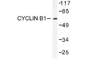 Image no. 1 for anti-Cyclin B1 (CCNB1) antibody (ABIN271880) (Cyclin B1 Antikörper)