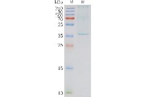 Human N-Nanodisc, Flag Tag on SDS-PAGE (NTSR1 Protein)