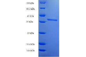 SDS-PAGE (SDS) image for Sialophorin (SPN) (AA 20-253) protein (His-SUMO Tag) (ABIN5710412) (CD43 Protein (AA 20-253) (His-SUMO Tag))