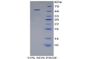 SDS-PAGE analysis of Pig Cathepsin L Protein. (Cathepsin L Protein)