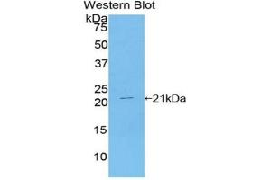 Detection of Recombinant TDP43, Human using Polyclonal Antibody to Tar DNA Binding Protein 43 kDa (TDP43) (TARDBP Antikörper  (AA 104-262))