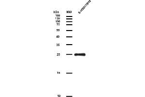 HSD17B10 Protein (AA 2-261) (S tag)