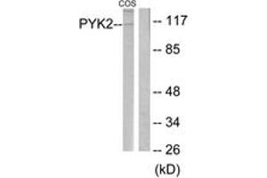 Western blot analysis of extracts from COS cells, treated with UV 15', using PYK2 (Ab-580) Antibody. (PTK2B Antikörper  (AA 546-595))