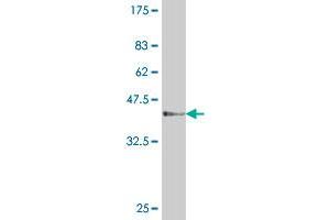 Western Blot detection against Immunogen (37 KDa) . (PCNA Antikörper  (AA 78-177))